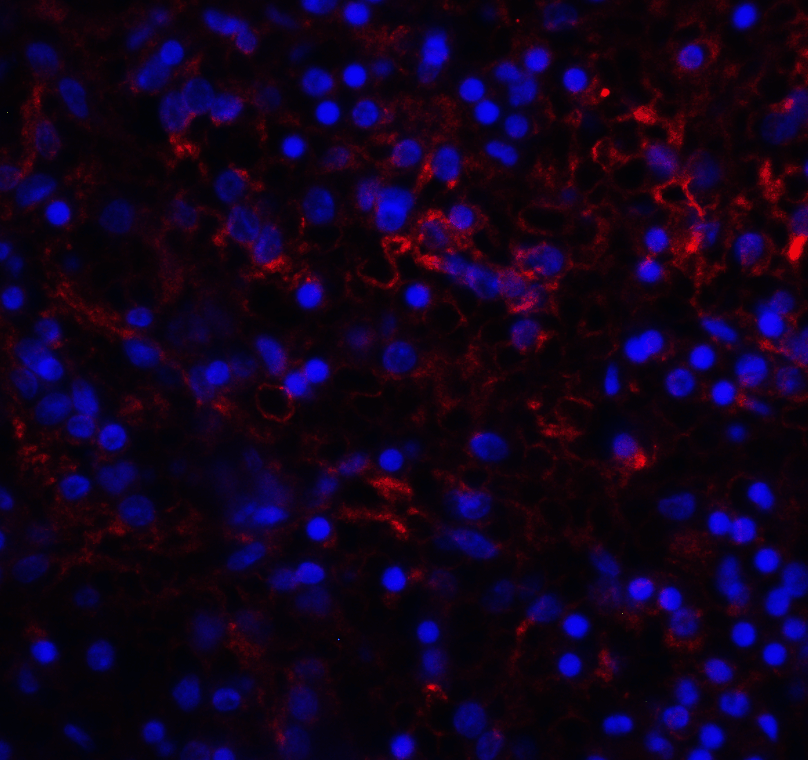 VISTA Antibody [6D2]