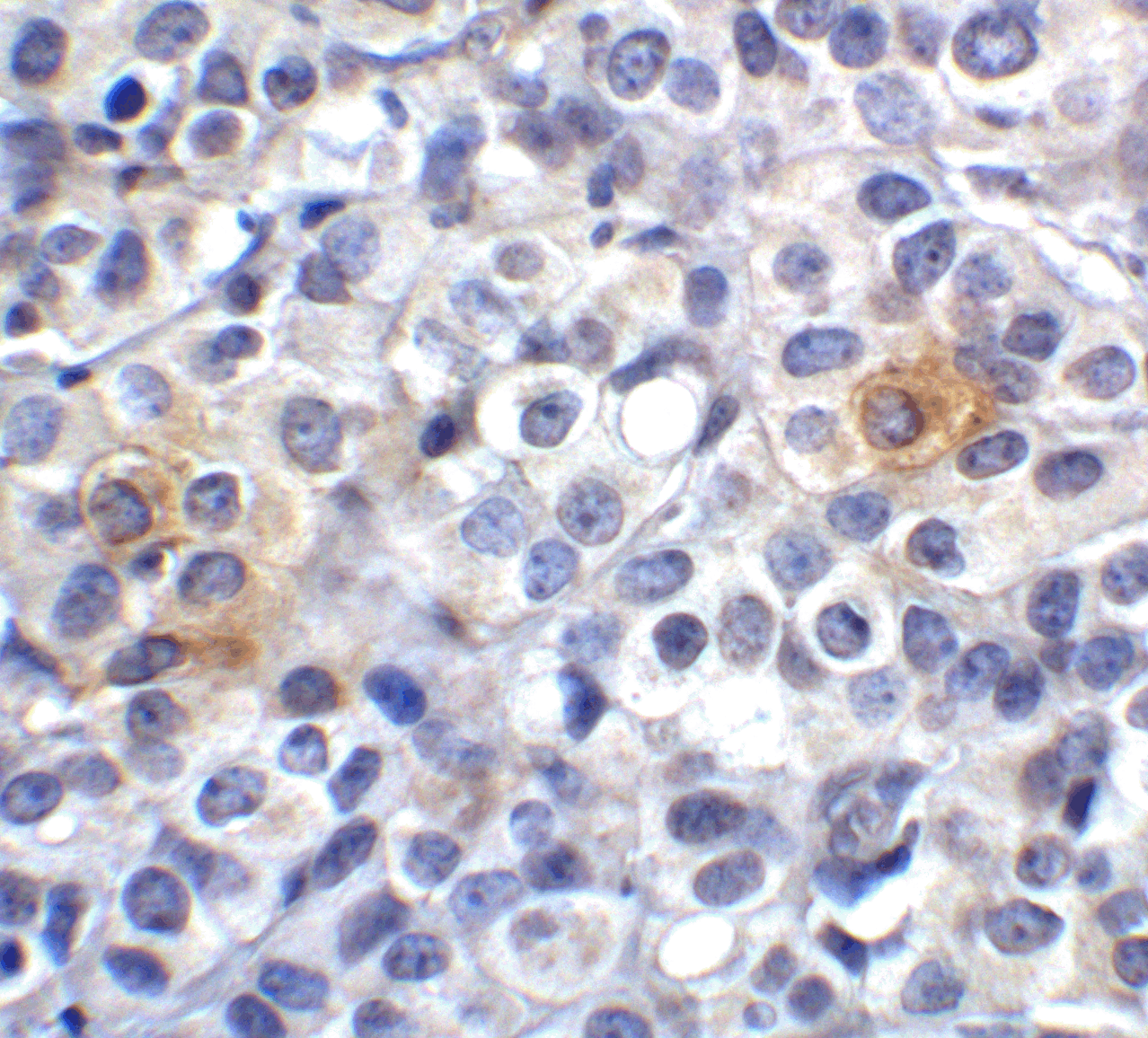 VISTA Antibody [9E4]