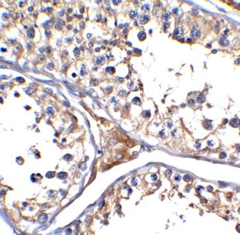 ACE2 Antibody (HRP)