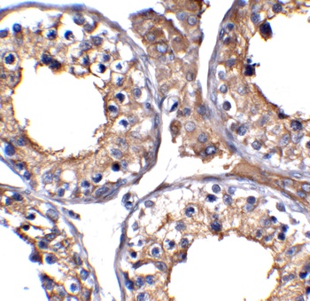 ACE2 Antibody (Biotin)