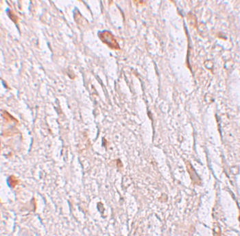 SLC39A7 Antibody