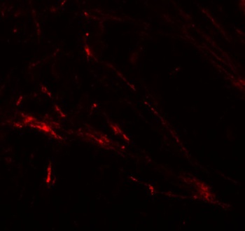 SLC39A7 Antibody