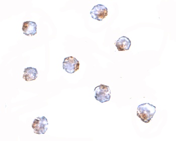 Aak1 Antibody