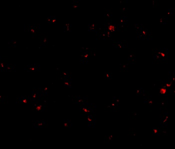 Aak1 Antibody