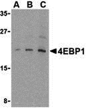 EIF4EBP1 Antibody