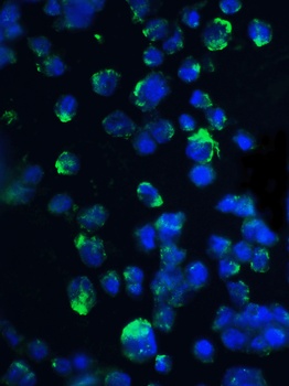 EIF4EBP1 Antibody