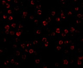 ACTB Antibody