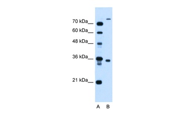 FLJ22167 Antibody