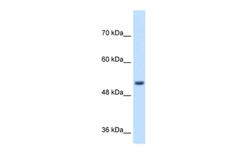 SPPL2B Antibody