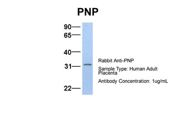 PNP Antibody
