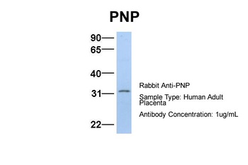 NP Antibody