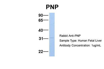 NP Antibody