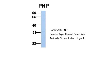 PNP Antibody