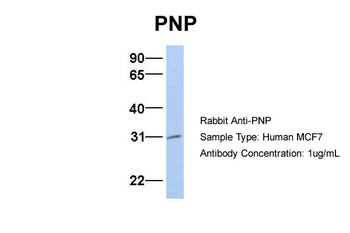 NP Antibody