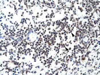 GABPB1 Antibody