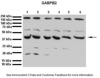 GABPB1 Antibody