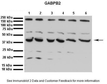 GABPB2 Antibody
