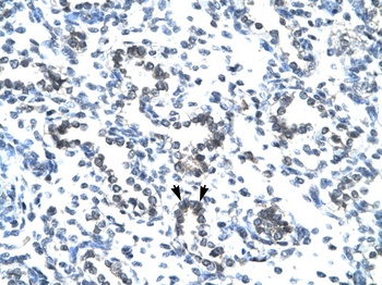 EVX1 Antibody
