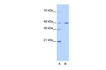 NR2F2 Antibody