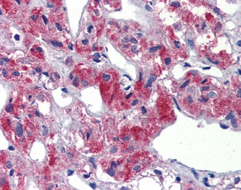 TAL1 Antibody