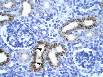 SERPINF1 Antibody