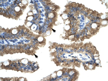 CHRNA1 Antibody