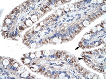 CCL18 Antibody