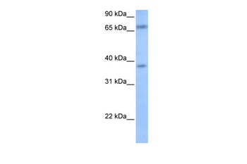 FEM1B Antibody