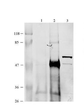 CCT6B Antibody