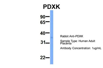 PDXK Antibody