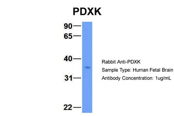 PDXK Antibody