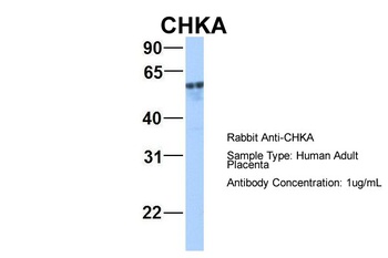 CHKA Antibody