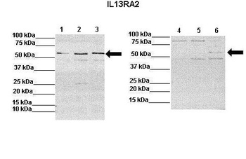 IL13RA2 Antibody