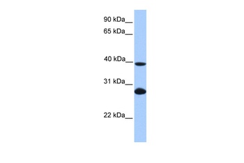 UBE2F Antibody