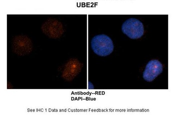 UBE2F Antibody