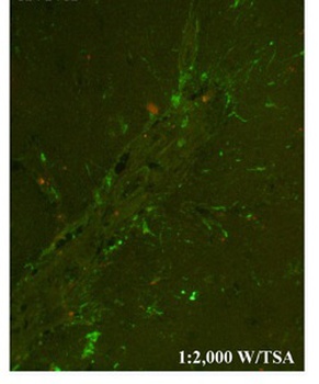 CHI3L1 Antibody