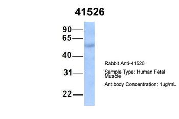 SEPT9(septin 9) Antibody