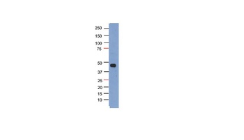 PHF6 Antibody