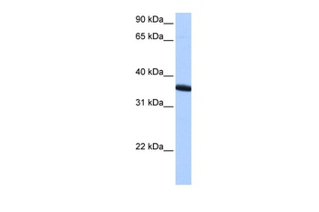 ZNF192P1 Antibody