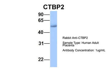 CTBP2 Antibody