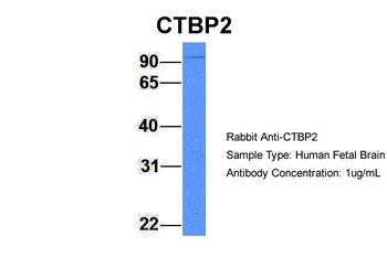 CTBP2 Antibody