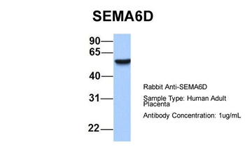 SEMA6D Antibody