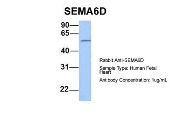 SEMA6D Antibody