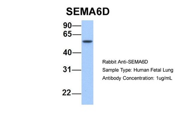 SEMA6D Antibody
