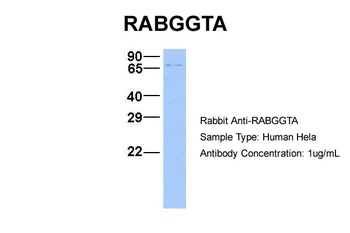 RABGGTA Antibody