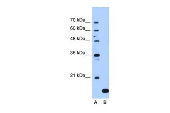 NAA50 Antibody