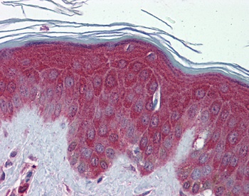 PRDX6 Antibody