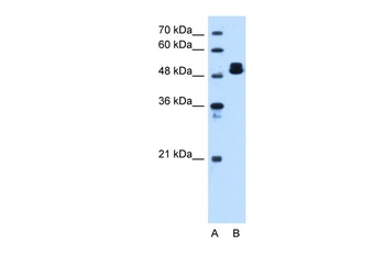 ATP5B Antibody