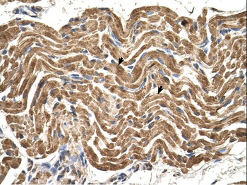 ATP5B Antibody