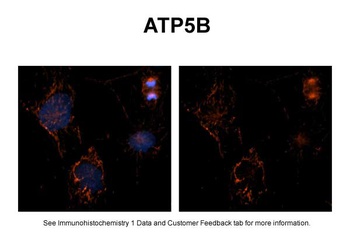 ATP5B Antibody